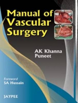 Книга Manual of Vascular Surgery A.K. Khanna
