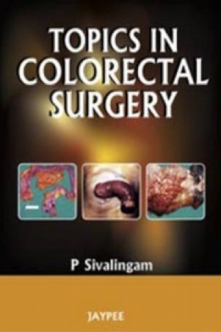 Książka Topics in Colorectal Surgery P. Sivalingam