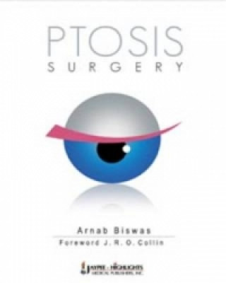 Book Ptosis Surgery Arnab Biswas