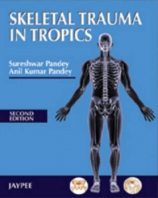 Kniha Skeletal Trauma in Tropics Sureshwar Pandey