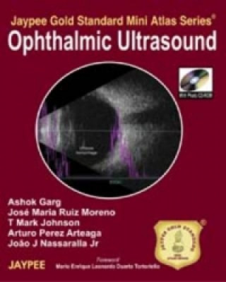 Könyv Jaypee Gold Standard Mini Atlas Series: Ophthalmic Ultrasound Ashok Garg