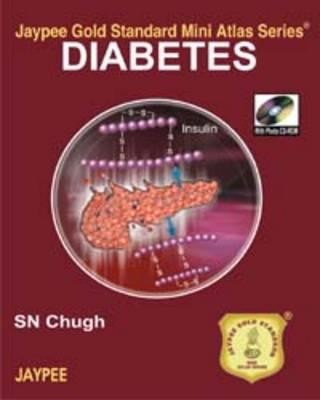 Carte Jaypee Gold Standard Mini Atlas Series: Diabetes S. N. Chugh