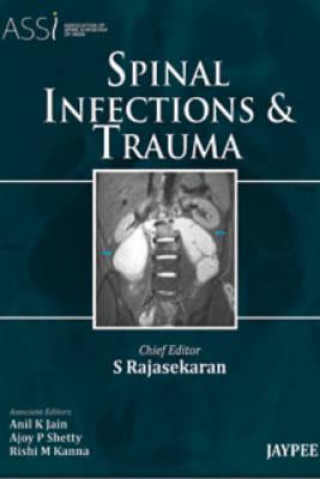 Buch Spinal Infections and Trauma S. Rajasekaran