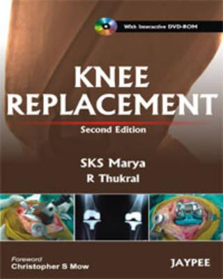 Kniha Knee Replacement S. K. S. Marya