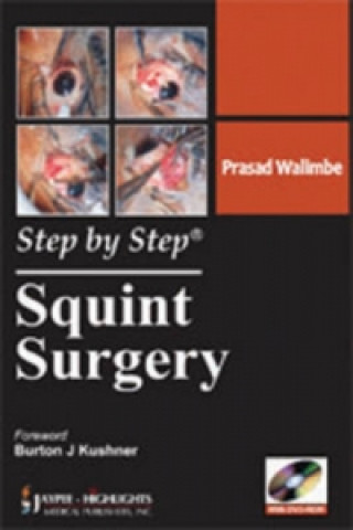 Kniha Step by Step: Squint Surgery Prasad Walimbe