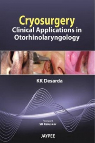 Könyv Cryosurgery K. K. Desarda