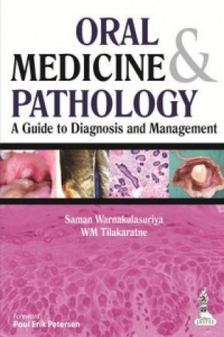 Carte Oral Medicine & Pathology:  A Guide to Diagnosis and Management Saman Warnakulasuriya