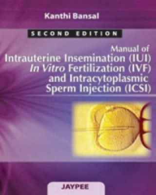 Carte Manual of Intrauterine Insemination (IUI), In Vitro Fertilization (IVF) and Intracytoplasmic Sperm Injection (ICSI) Kanthi Bansal