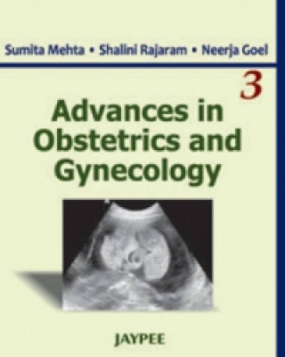 Kniha Advances in Obstetrics and Gynecology Sumita Mehta