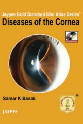 Könyv Jaypee Gold Standard Mini Atlas Series: Diseases of the Cornea Samar Kumar Basak