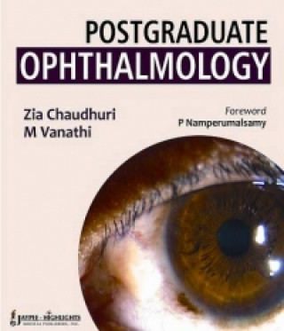 Kniha Postgraduate Ophthalmology, Two Volume Set Zia Chaudhuri