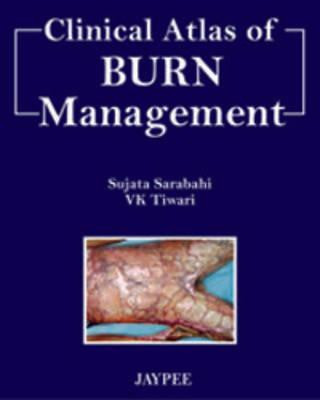Carte Clinical Atlas of Burn Managment Sujata Sarabahi