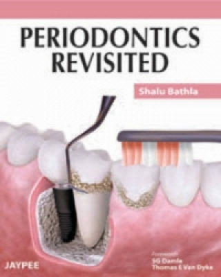 Książka Periodontics Revisited Shalu Bathla