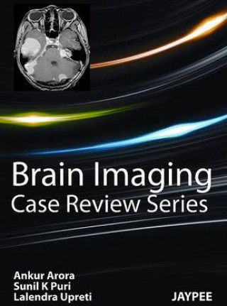 Knjiga Brain Imaging Ankur Arora