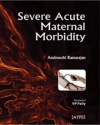 Kniha Severe Acute Maternal Morbidity Arulmozhi Ramarajan