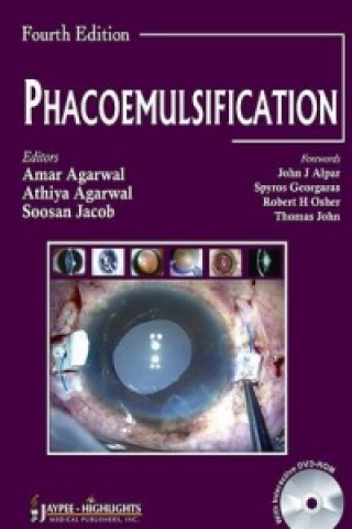 Knjiga Phacoemulsification, Fourth Edition Amar Agarwal