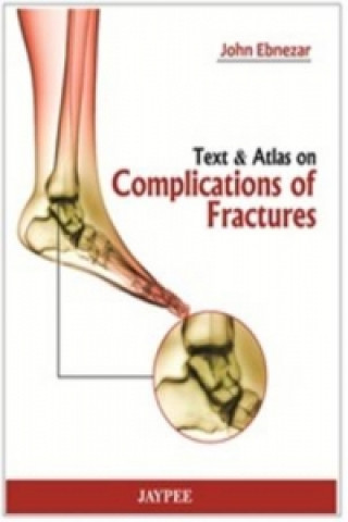 Książka Text and Atlas of Complications of Fractures John Ebnezar