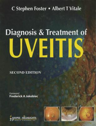 Kniha Diagnosis & Treatment of Uveitis C. Stephen Foster