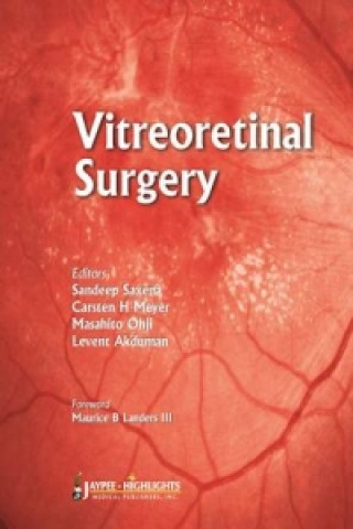 Book Vitreoretinal  Surgery 