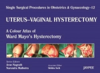 Knjiga Single Surgical Procedures in Obstetrics and Gynaecology - Volume 12 - UTERUS - VAGINAL HYSTERECTOMY Arun Nagrath