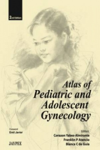 Carte Atlas of Pediatric and Adolescent Gynecology 