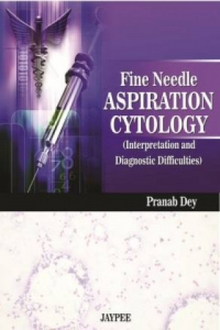 Carte Fine Needle Aspiration Cytology Interpretation and Diagnostic Difficulties Pranab Dey