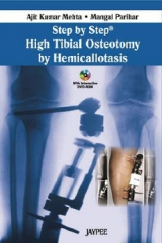 Книга Step by Step: High Tibial Osteotomy by Hemicallotasis Ajit  Kumar Mehta