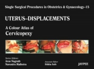 Carte Single Surgical Procedures in Obstetrics and Gynaecology - Volume 15 - UTERUS - DISPLACEMENTS Arun Nagrath