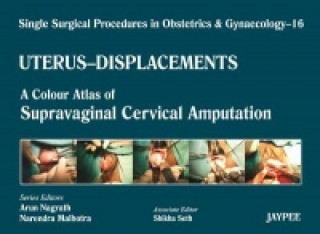 Carte Single Surgical Procedures in Obstetrics and Gynaecology - Volume 16 - UTERUS - DISPLACEMENTS Arun Nagrath
