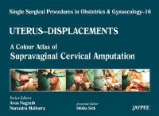 Książka Single Surgical Procedures in Obstetrics and Gynaecology - Volume 16 - UTERUS - DISPLACEMENTS Arun Nagrath