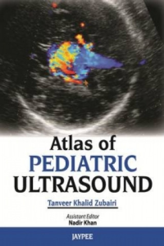 Kniha Atlas of Pediatric Ultrasound Tanveer Khalid Zubairi