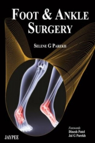 Книга Foot and Ankle Surgery Selene G. Parekh