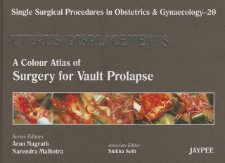 Carte Single Surgical Procedures in Obstetrics and Gynaecology - Volume 20 - UTERUS - DISPLACEMENTS Arun Nagrath