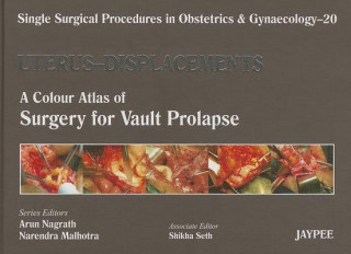 Buch Single Surgical Procedures in Obstetrics and Gynaecology - Volume 20 - UTERUS - DISPLACEMENTS Arun Nagrath