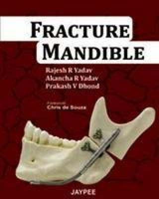 Carte Fracture Mandible Rajesh R. Yadav