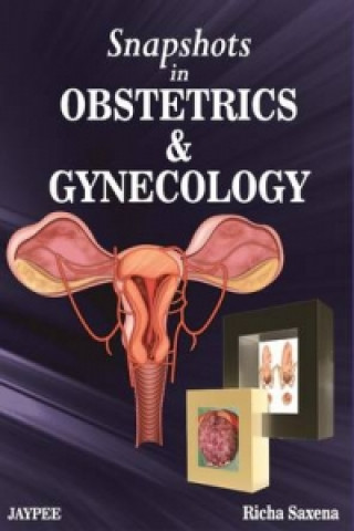 Könyv Snapshots in Obstetrics and Gynaecology Richa Saxena