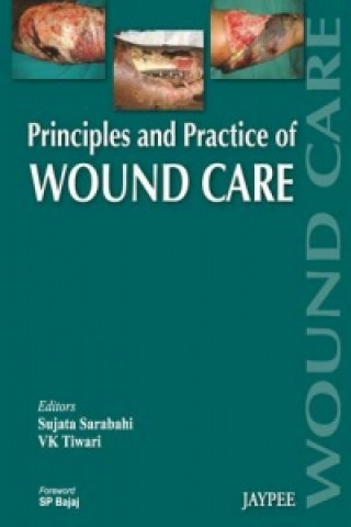 Carte Principles and Practice Of Wound Care Sujata Sarabahi