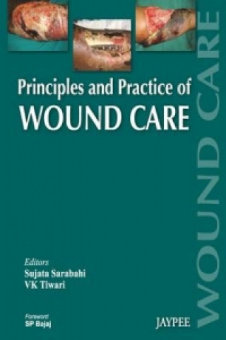 Kniha Principles and Practice Of Wound Care Sujata Sarabahi