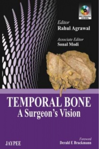 Könyv Temporal Bone Rahul Agrawal