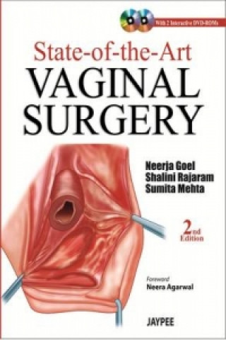 Carte State-of-the-Art Vaginal Surgery Sumita Mehta