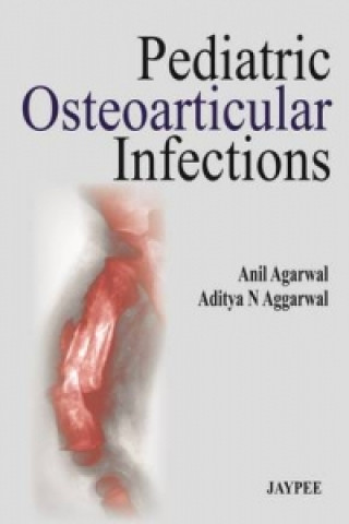 Книга Pediatric Osteoarticular Infections Anil Agarwal