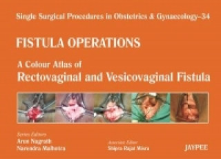 Carte Single Surgical Procedures in Obstetrics and Gynaecology - 34 - Fistula Operations: A Colour Atlas of Rectovaginal and Vesicovaginal Fistula Arun Nagrath