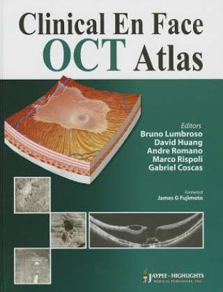Kniha Clinical En Face OCT Atlas Bruno Lumbroso