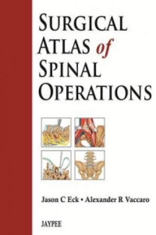 Kniha Surgical Atlas of Spinal Operations Alexander R. Vaccaro