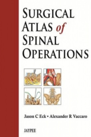 Book Surgical Atlas of Spinal Operations Alexander R. Vaccaro