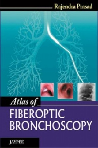 Knjiga Atlas of Fiberoptic Bronchoscopy Rajendra Prasad