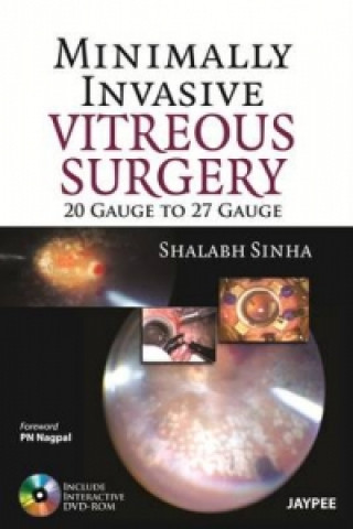 Kniha Minimally Invasive Vitreous Surgery: 20 Gauge to 27 Gauge Shalabh Sinha