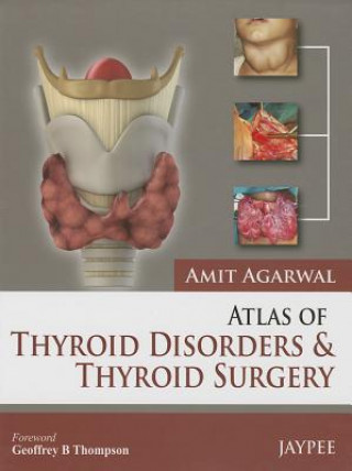 Kniha Atlas of Thyroid Disorders and Thyroid Surgery Amit Agarwal