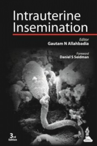 Kniha Intrauterine Insemination Gautam N. Allahbadia