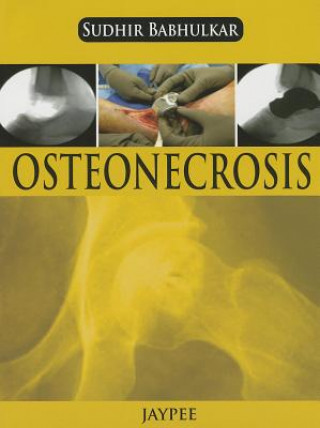 Book Osteonecrosis Sudhir Babhulkar